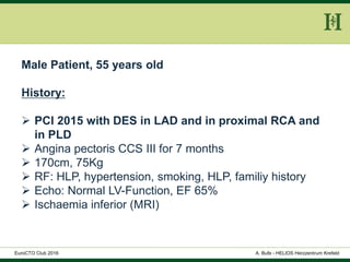 HELIOS Klinikum Wuppertal - HerzzentrumHELIOS Klinikum Wuppertal - Herzzentru
A. Bufe - HELIOS Herzzentrum KrefeldEuroCTO Club 2016
Male Patient, 55 years old
History:
 PCI 2015 with DES in LAD and in proximal RCA and
in PLD
 Angina pectoris CCS III for 7 months
 170cm, 75Kg
 RF: HLP, hypertension, smoking, HLP, familiy history
 Echo: Normal LV-Function, EF 65%
 Ischaemia inferior (MRI)
 