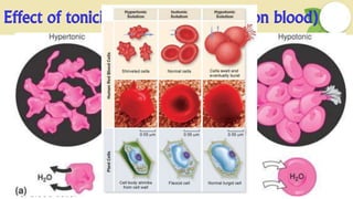 Effect of tonicity on body( Injection on blood)
The solutions which are not isotonic with plasma may be harmful to use. On
injecting the hypotonic solutions into blood stream, it may enter the blood cells
in an attempt to produce equilibrium, the cells swells rapidly until they
burst leading to hemolysis. As this damage is irreversible may lead to serious
danger to RBC.
When hypertonic solution is injected into the blood stream, the water comes
out of the membrane of RBC in order to reach equilibrium. The cells shrink
leading to crenulation which is only a temporary damage. When the osmotic
pressure of two solutions becomes equal the damaged cells will come to its
original position. Hence hypertonic solutions may therefore be administered
without permanent damage to the blood cells. They should be injected slowly
to ensure rapid dilution into the blood stream and to minimize the crenulation
of blood cells.
 