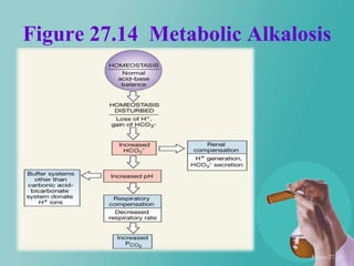 Figure 27.14 Metabolic Alkalosis




                             Figure 27.14
 