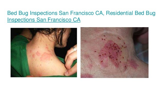 San Francisco Exterminator Bed Bugs San Francisco Exterminator Bed Bugs