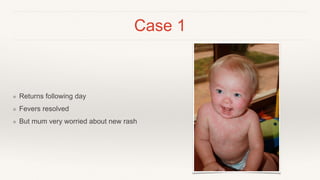 Case 1
❖ Returns following day
❖ Fevers resolved
❖ But mum very worried about new rash
 
