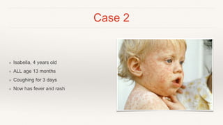 Case 2
❖ Isabella, 4 years old
❖ ALL age 13 months
❖ Coughing for 3 days
❖ Now has fever and rash
 