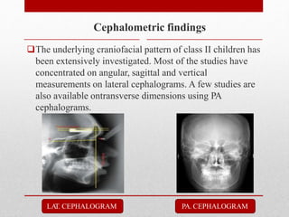 The underlying craniofacial pattern of class II children has
been extensively investigated. Most of the studies have
concentrated on angular, sagittal and vertical
measurements on lateral cephalograms. A few studies are
also available ontransverse dimensions using PA
cephalograms.
Cephalometric findings
PA. CEPHALOGRAM
LA
T. CEPHALOGRAM
 