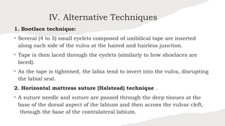 Large-Animal_Buhner-Suture-MethodsDIANITO.pptx