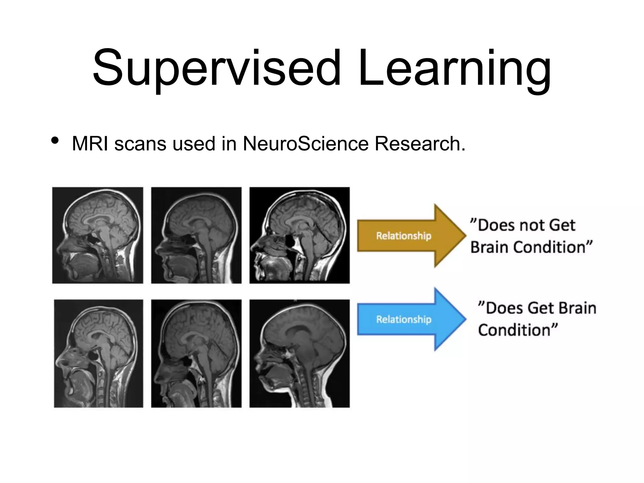 Supervised Learning
• MRI scans used in NeuroScience Research.
 