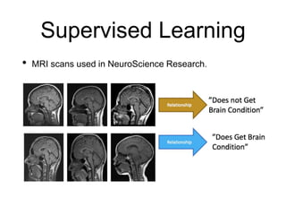 Supervised Learning
• MRI scans used in NeuroScience Research.
 