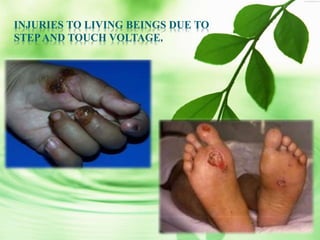 INJURIES TO LIVING BEINGS DUE TO
STEPAND TOUCH VOLTAGE.
 