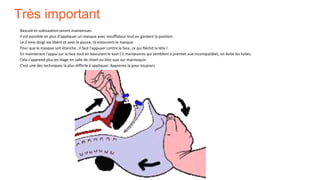 Très important
Bascule et subluxation seront maintenues
Il est possible en plus d'appliquer un masque avec insufflateur tout en gardant la position.
Le 2 ème doigt est libéré et avec le pouce, ils entourent le masque
Pour que le masque soit étanche , il faut l'appuyer contre la face, ce qui fléchit la tête !
En maintenant l'appui sur la face tout en basculant le tout ( 2 manœuvres qui semblent à premier vue incompatible), on évite les fuites.
Cela s'apprend plus en stage en salle de réveil ou bloc que sur mannequin
C'est une des techniques la plus difficile à appliquer. Apprenez la pour toujours
 
