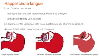 Rappel chute langue
Lors d'une inconscience:
la langue bascule vers la partie postérieure du pharynx.
la mâchoire tombe vers l'arrière
La distance entre la langue et la paroi postérieure du pharynx se rétrécit.
Au pire l'obstruction du pharynx est complète.
Langue en position normale Chute de la langue chez un inconscient Obstruction de la paroi postérieure du pharynx
 