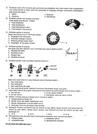 32' Peradangan pada nefron terutama. pada glomerulusyang disebabkan oleh infe'ksi baKeri maka mengakibatkan, urine masuk k...