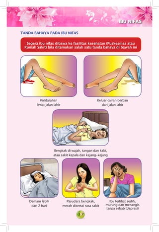 17
TANDA BAHAYA PADA IBU NIFAS
Pendarahan
lewat jalan lahir
Keluar cairan berbau
dari jalan lahir
Bengkak di wajah, tangan dan kaki,
atau sakit kepala dan kejang-kejang
Demam lebih
dari 2 hari
Payudara bengkak,
merah disertai rasa sakit
Ibu terlihat sedih,
murung dan menangis
tanpa sebab (depresi)
IBU NIFAS
Segera ibu nifas dibawa ke fasilitas kesehatan (Puskesmas atau
Rumah Sakit) bila ditemukan salah satu tanda bahaya di bawah ini
 
