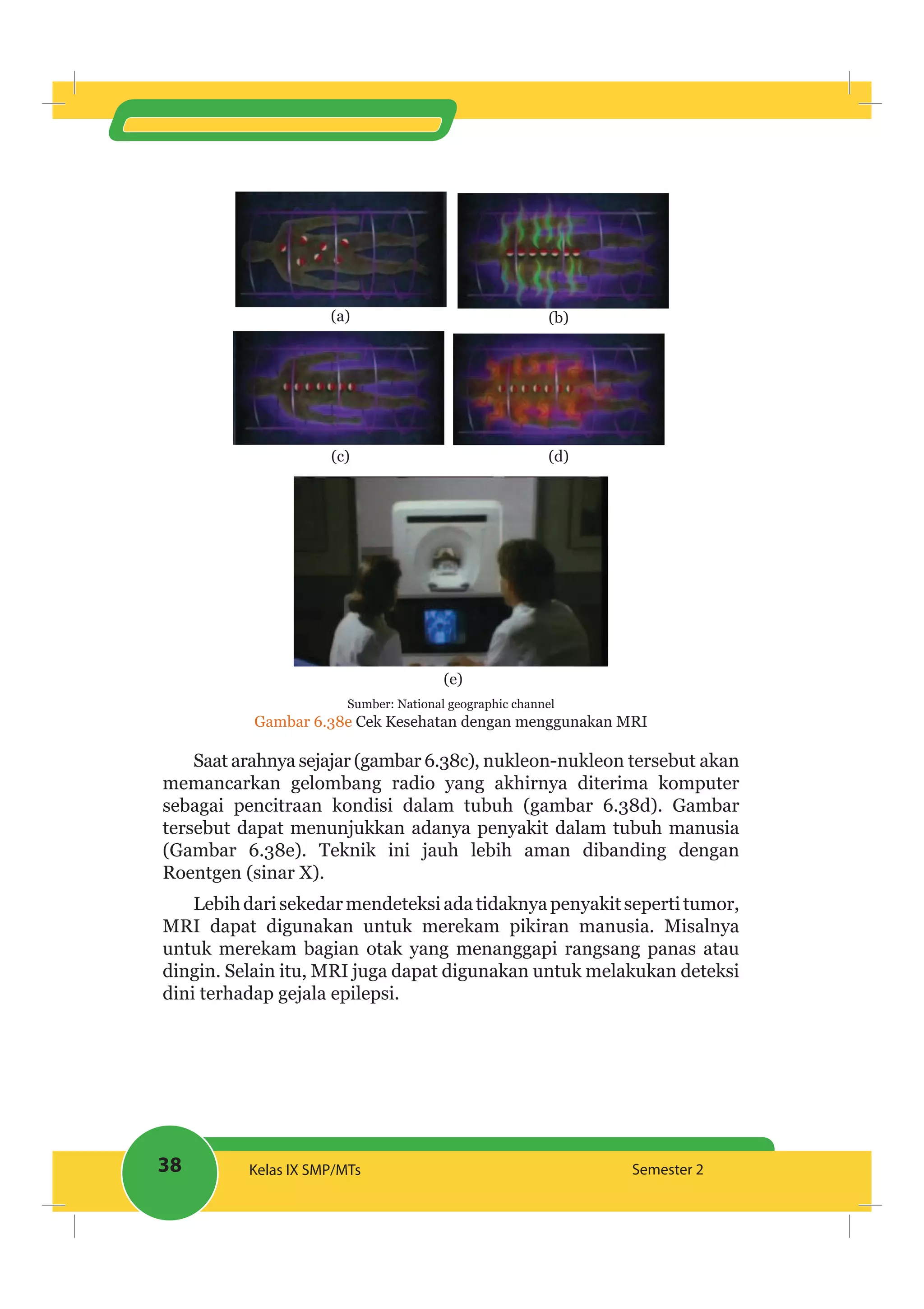 38 Kelas IX SMP/MTs Semester 2
(a) (b)
(c) (d)
(e)
Sumber: National geographic channel
Gambar 6.38e Cek Kesehatan dengan menggunakan MRI
Saat arahnya sejajar (gambar 6.38c), nukleon-nukleon tersebut akan
memancarkan gelombang radio yang akhirnya diterima komputer
sebagai pencitraan kondisi dalam tubuh (gambar 6.38d). Gambar
tersebut dapat menunjukkan adanya penyakit dalam tubuh manusia
(Gambar 6.38e). Teknik ini jauh lebih aman dibanding dengan
Roentgen (sinar X).
Lebihdarisekedarmendeteksiadatidaknyapenyakitsepertitumor,
MRI dapat digunakan untuk merekam pikiran manusia. Misalnya
untuk merekam bagian otak yang menanggapi rangsang panas atau
dingin. Selain itu, MRI juga dapat digunakan untuk melakukan deteksi
dini terhadap gejala epilepsi.
 