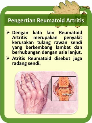 Pengertian Reumatoid Artritis
 Dengan kata lain Reumatoid
Artritis merupakan penyakit
kerusakan tulang rawan sendi
yang b...