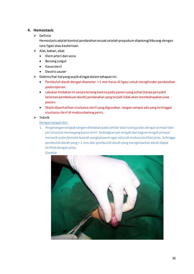 Buku Step By Step Tobe A Great Operator Circumcision PDF buku-step-by-step-tobe-a-great-operator-circumcision-pdf
