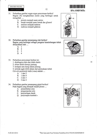 DOKUMENNEGARA
31. Perhatikan gambar organ-organ pencernaan berikut!
Bagian (X) menghasilkan enzim yang berfungsi untuk
mengubah ....
A. protein menjadi asam amino
B. lemak menjadi asam lemak dan gliserol
C. amilum menjadi maltosa
D. maltosa menjadi glukosa
Perhatikan gambar penampang otak berikut!
Bagian yang berfungsi sebagai pengatur keseimbangan tubuh
ditunjukkan oleh ....
A. I
8.2
c.3
D.4
Perhatikan pernyataan berikut ini :
1. dindingnya tipis dan tidak elastis
2. aliran darah menuju jantung
3. terdapat satu katup dekatjantung
4. terletak agak lebih dalam dari permukaan tubuh
Ciri-ciri pembuluh balik (vena) adalah ....
A. I dan2
B. I dan4
C. 2 dan3
D. 2 dan4
Perhatikan gambar penampang ginjal berikut!
Pada bagian yang ditunjuk terjadi proses ....
A. penambahan urea
B. pengumpulan urin
C. penyaringan darah
? PenYerapan kembali-
lillfit]illililffi]ll
MP/MTs
t2
TPA S
32.
JJ.
34.
2
1
P-ZF-2013/2014 %tak Cipta pacla Pusat Penilaian Pendkl ikan-BALITBANG-KEMDIKBUt)
 