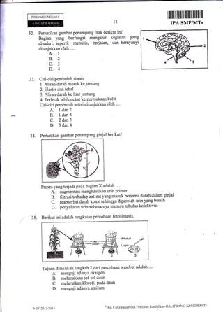 DOKUMENNEGARA
13
ffiil|ilfiilffililllffiffilllllfiilffi
TPA SMPIVITS
32. Perhatikan gambar penampang otak berikut ini!
Bagian yang berfungsi mengatur kegiatan yang
disadari, seperti: menulis, berjalan, dan bernyanyi
ditunjukkan oleh ....
A. 1
B.2
c.3
D.4
Ciri-ciri pembuluh darah:
1. Aliran darah masuk ke jantung
2. Elastis dan tebal
3. Aliran darah ke luar jantung
4. Terletak lebih dekat ke perrnukaan kulit
Ciri-ciri pembuluh arteri ditunjukkan oleh ".'
A. I dan2
B. ldan4
C. 2 dan3
D. 3 dan4
Perhatikan gambar penampang ginjal berikut!
JJ.
34.
35.
Proses yang terjadi pada bagian X adalah ""
A. augmentasi menghasilkan urin primer
B. filtrasi terhadap iat-zatyang misuk bersama darah dalam ginjal
C.reabsorbsidarahkotorsehinggadiperolehurinyangbersih
D. penyaluran urin sebenarnya menuju tubulus kolektivus
Berikut ini adalah rangkaian percobaan fotosintesis'
Tujuan dilakukan langkah 2 daripercobaan tersebut adalah .'..
A. menguji adanYa oksigen
B. melunakkan sel-sel daun
C. melarutkan klorofil Pada daun
D. menguji adarrYaamilum
")f{ak Clipta pacla ['usirt Pcnilait.rn Pendiclikan-l]ALrTBANG-KEN4DIKBtJD
*Alkohol
/i#
uugot.;;t!:a^
w,w
3
P-7.r-20t312014
 