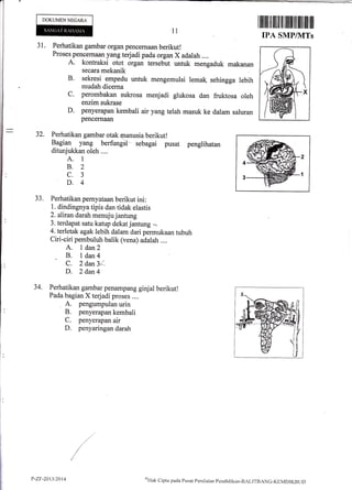 DOKUMENNEGARA
31. Perhatikan gambar organ pencernaan berikut!
Proses pencern&m yang terjadi pada organ X adalah ....
A. kontraksi otot organ tersebut untuk mengaduk makanan
11
ilililtilIil ilililil tililililililililililtil
IPA SNTPIVITs
secara mekanik
B. sekresi empedu untuk mengemulsi
mudah dicerna
c. perombakan sukrosa menjadi glukosa dan fruktosa oleh
enzim sukrase
D. penyerapan kembali air yang telah masuk ke dalam saluran
pencerniuul
lemak sehingga lebih
32,
JJ.
Perhatikan gambar otak nanusia berikut!
Bagian yang berfungii sebagai pusat penglihatan
ditunjukkan oleh ....
A. 1
8.2
c.3
D.4
Perhatikan pernyataan berikut ini:
1. dindingnya tipis dan tidak elastis
2. alirandarah menuju jantung
3. terdapat satu katup dekat jantung -,.
4. terletak agak lebih dalam dari permukaan tubuh
Ciri-ciri pembuluh balik (vena) adalah ....
A. I dan2
B. l dan4' C. 2 dan3L
D. 2 dan4
Perhatikan gambar penampang ginjal berikut!
Pada bagian X terjadi proses ....
A. pengumpulan urin
B. penyerapan kembali
C. penyerapan air
D. penyaringan darah
/
34.
P-ZF-2013/2014 c'Htrk
Clipta pada Pusar Pcnilirian pcndiclikan-B.,LlT'BANG-J<EN{DIKIItlL)
 