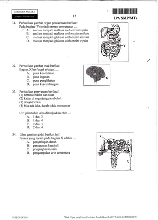 r,,
-l
I
DOKUMENNEGARA
31. Perhatikan gambar organ pencernaan berikut!
Pada bagian (Y) terjadi proses pencem&m ....
7' A,. amilum menjadi maltosa oleh enzim tripsin
B. amilum menjadi maltosa oleh enzim amilase
C. maltosa menjadi glukosa oleh enzim amilase
D. maltosa menjadi glukosa oleh enzim tripsin
Perhatikan gambar otak berikut!
Bagian X berfungsi sebagai ....
A. pusat kecerdasan
B. pusat ingatan
C. pusat penglihatan
D. pusat keseimbangan
Perhatikan pernyataan berikut !
(1) bersifat elastis dan kuat
(2) katup di sepanjang pembuluh
(3) denyut terasa
(4) bila ada luka, darah tidak mernarLcar
Ciri pembuluh vena ditunjukkan oleh ....
A. ldan 3
B, ldan4
C. 2dan 3
D. 2dan 4
Lihat gambar ginjal berikut ini!
Proses yang terjadi pada bagian X adalah ....
A. penyaringan darah
B. penyerapan kembali
C. pengangkutan urin
D. pengumpulan urin sementara
12
ililtililil ilffi lll llllll lil llll llil llil
IPA SMP/]VITs
32.
JJ.
34.
P-7-.r-2013t2014
oi)Hak
Cipta pacla I'usirt Penilaian Pendidiktin'BALITBiNG'l(EIvIDIKBt.iD
 