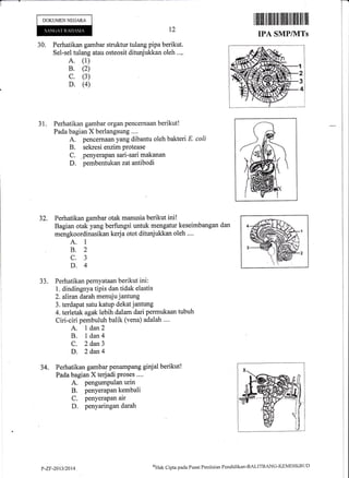 r:-+
DOKUMEN NEGARA
30. Perhatikan gambar struktur tulang pipa berikut.
Sel-sel tulang atau osteosit ditunjukkan oleh ..,.
A. (1)
B. (2)
c. (3)
D. (4)
t2
r tl!ilil ril ililt til lillffi lil lffil lil llil
IPA SMP/NTTS
31. Perhatikan gambar organ pencernaan berikut!
Pada bagian X berlangsung ....
A. pencernaan yang dibantu oleh bakteri E. coli
B. sekresi enzim protease
C. ltenyerapan sari-sari makanan
D. pembentukan zatantibodi
Perhatikan gambar otak manusia berikut ini!
Bagian otak yang berfungsi untuk mengatur keseimbangan dan
mengkoordinasikan kerja otot ditunjukkan oleh ....
A. I
B.2
c.3
D.4
Perhatikan pernyataan berikut ini :
1. dindingnya tipis dan tidak elastis
2. alfuandarah m.enuju jantung
3. terdapat satu katup dekatjantung
4. terletak agak lebih dalam dari permukaan tubuh
Ciri-ciri pembuluh balik (vena) adalah .".
A. l dan2
B. 1dan4
C. 2 dan3
D. 2 dan4
Perhatikan gambar penampang ginjat berikut!
Pada bagian X terjadi Proses ....
A. pengumpulan urin
B. penyerapan kembaii
C. penyerapan air
D. penyaringan darah
52.
53.
34.
I
8.
$
,lt,
P-ZF-201312014
$Hak Cipta pacla Pusat Peirilaitrn Pendidiktut-BALITBANG-KEMDIKBt.lt)
 
