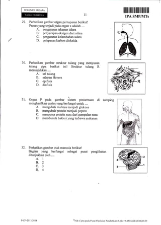 DOKUMEN NEGARA
29. Perhatikan gambar ofgan pemapasan berikut!
Proses yang terjadi phda organ x adalah ....
A. pengaturan tekanan ddara
B. penyerapan oksigen dari udara
C. pengaturan kelembaban udara
D. pelepasan karbon dioksida
30. Perhatikan gambar struktur tulang yang menyusun
tulang pipa berikut ini! Stnrktur tulang R
menunjukkan....
A. sel tulang
B. saluran Havers
C. epifisis
D. diafisis
31. Organ P pada gambar sistem pencernaan di samping
menghasilkan enzim yang berfungsi untuk ....
A. mengubah maltosa menjadi glukosa
B. mengubah protein menjadi pepton
C. mencerna prcltein susu dari gumpalan susu
D. membunuh bakteri yang terbawa makanan
32. Perhatikan gambar otak manusia berikut!
Bagian yang berfungsi sebagai pusat penglihatan
ditunjukkan oleh ....
A. 1
B.2
c.3
D.4
11
2
1
P-ZF-2013/2014 ol-Iak Clipta pacla Pusat Penihian Pcndiclikal-BALITB,,NC-KEMDIKBTJD
 