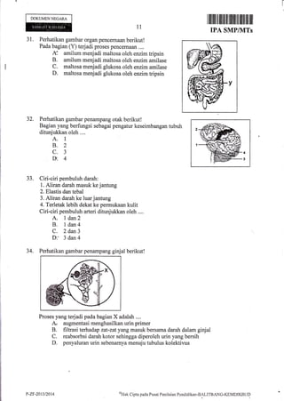 DOKUMENNEGARA
31. Perhatikan gambar organ pencernaan berikut!
Pada bagian (Y) terjadi proses pencernaan ....
l( amilum menjadi maltosa oleh enzim tripsin
B. amilum menjadi maitosa oleh enzim amilase
C. maltosa menjadi-glukosa oleh enzim amilase
D, maltosa menjadi glukosa oleh enzirn tripsin
32. Perhatikan gambar penampang otak berikut!
Bagian yang berfungsi sebagai pengatur keseimbangan tubuh
ditunjukkan oleh ....
A. 1
B.2
c.3
V,4
33. Ciri-ciri pembuluh darah:
1. Aliran darah masuk ke jantung
2. Elastis dan tebal
3. Aliran darah ke luar jantung
4. Terletak lebih dekat ke permukaan kulit
Ciri-ciri pembuluh arteri ditunjukkan oleh ,...
A. I dan2
B. I dan4
C. 2 dan3
D: 3 dan4
11
34. Perhatikan gambar penampang ginjal berikut!
Proses yang terjadi pada bagian X adalah ....
N augmentasi menghasilkan urin primer
B. filtrasi terhadap zat-zat yang masuk bersama darah dalam ginjal
C. reabsorbsi darah kotor sehingga diperoleh urin yang bersih
D. penyaluran urin sebenarnya menuju tubulus kolektivus
I lllillil lil ililt til tffiiilil ililt tlfl ilil
IPA SMP/1VITs
()Hak
Clipta pacla Pusat Pcnilairu Penriiclikan-BALITBANC-KEMDIKBUDP-ZF-2013t2014
 