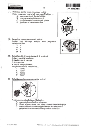 DO,KIJMENNECARA
31. Perhatikan gambar sistern pencernaan berikut!
Proses pencernaan yang terjadi pada organ X adalah ....
A. pencemaan lernak dan karbohidrat
B. penyerapan vitamin dan mineral
C. perubahan asam lemak menjadi gliserol
D. pernbusukan sisa-sisa nrakanan
32. Perhatikan gambar o,tak manusia berikut!
Bagian yang berfungsi sebagai pusat pengtrihatan
ditunjukkan oleh ....
A. 1
8.2
c.3
D.4
33. Perhatilcan ciri-siri pembuluh darah di bawah ini!
1. hanya memiliki satu katup
2.lika luka, darah menetes
3, denyut terasa
4. banyak mengangkut CO2
Ciri pembuluh darah arteri adalah ....
A. I dan3
B. l dan4
C. 2 dart S
D. 2 dan4
l1
34. Perhatikan gambar penarnpang ginjal berikutl
Proses yang terjadi pada bagian X adalah "...
A. augmentasi menghasilkan urin prirner
B. filtrasi terhadap zat-zat yang masuk bersama darah dalam ginjal
C. reabsorbsi darah kotor sehingga diperoleh urin yang bersih
D. penyaluran urin sebenarnya menuju tubulus kolektilus
Iiltilffiilfiilfi[IffifiIffifiIilffiilil
IPA SMPltt{Ts
2
I
t,-zF-2013/2014 oFIak
Clipta pacla Pusat Pbniltritrn Pencliclikan-BALITBANC-KEI,IDIKEIJD
 