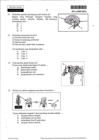DOKUMEN NEGARA
32. Perhatikan gambar penampang otak berikut ini!
Bagian yang berfungsi mengatur kegiatan yang
disadari, seperti: menulis, berjalan, dan bernyanyi
ditunjukkan oleh ....
M1
B.2
c.3
D.4
Perhatikan pernyataan berikut!
(1) bersifat elastis dan kuat
(2) katup di sepanjang pembuluh
(3) denyut terasa
(4) bila ada luka, darah tidak memancar
Ciri pembuluh vena ditunjukkan oleh ....
A. 1dan3
81 1 dan 4.
C. 2dan 3
D. 2dan 4
Lihat gambar ginjal berikut ini!
Proses yang terjadi pada bagian X adalah .,r.
+ PenYaringandarah
B. 'penyerapan kembali
C. pengangkutan urin
D. pengumpulan urin sementara
35. Berikut ini adaiah rangkaian percobaan fotosintesis.
IPA SMP/]VITs
t2
JJ.
34.
Tujuan dilakukan langkah 2 dafi percobaan tersebut adalah ..'.
A. menguji adanya oksigen
B. melunakkan sel-sel daun
C. melarutkan klorofil pada daun
D. menguji adanya amilum
P-ZF-201712014
atHtik
Cipra pada Pusat Penilaian Pendidikan-BALITBANG-I(EN4DIKBtlI)
 
