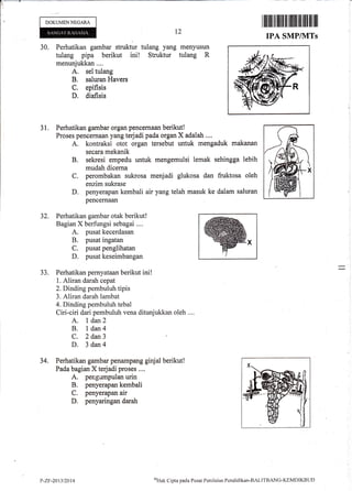 DOKUMENNEGARA
30. Perhatikan gambar struktur tulang yang
tulang pipa berikut ini! Struktur
menunjukkan....
A. sel tulang
B. saluran Havers
C. epifisis
D, diafisis
12
menyusun
tulang R
31. Perhatikan gambar organ pencernaan berikut!
Proses pencemaan yang terjadi pada organ X adalah ,..,
A. kontraksi otot organ tersebut untuk mengaduk makanan
secara mekanik
B. sekresi empedu untuk mengemulsi lemak sehingga lebih
mudah dicerna
C. perombakan sukrosa menjadi glukosa dan fruktosa oleh
enzim sukrase
D. penyerapan kembali air yang telah masuk ke dalam saluran
pencernaan
32.
75.
34,
Perhatikan gambar otak berikut!
Bagian X berfungsi sebagai ....
A. pusat kecerdasan
B. pusat ingatan
C. pusat penglihatan
D. pusat keseimbangan
Perhatikan pernyataan berikut ini !
1. Aliran darah cepat
2. Dinding pembuluh tipis
3. Aliran darah lambat
4. Dinding pembuluh tebal
Ciri-ciri dari pembuluh vena ditunjukkan oleh ....
A. I dan2
B. 1dan4
C. 2 dan3
D. 3 dan4
Perhatikan gambar penampang ginjal berikut!
Pada bagian X terjadi proses ....
A. peng'dmpulan urin
B. penyerapan kembali
C. penyerapan air
D. penyaringan darah
I lIlilil ffi fiilt ffi illllll lil llil llil ll]
IPA SMP/1VITs
P-ZF-201y2014
o)Htrk
C:ipta pacla Pusat Peniltrian,Pendiclikarr-BALITBnNC-KEMDIKBLID
 
