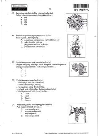 .T
DOKUMEN NEGARA
30. Perhatikan gambar struktur tulang pipa berikut.
Sei-sel tulang atau osteosit ditunjukkan oleh ..,.
A. (1)
B. (2)
c. (3)
D. (4)
t2
I iltillt til fiilt til lffiilt til ililt tilt til
IPA SMP/IVITs
31. Perhatikan gambar organ pencemaan berikut!
Pada bagian X berlangsung ....
A. pencernaan yang dibantu oleh bakten E. coli
B. sekresi enzimprotease
C. penyerapan sari-sari makanan
D. pembentukan zatantibodi
Perhatikan gambar otak manusia berikut ini!
Bagian otak yang berfungsi untuk mengatur keseimbangan dan
mengkoordinasikan kerja otot ditunjukkan oleh ....
A. I
B.2
c.3
D.4
Perhatikan pernyataan berikut ini:
1. dindingnya tipis dan tidak elastis
2, alirandarah m.enuju jantung
3. terdapat satu katup dekatjantung
4. terletak agak lebih dalam dari permukaan tubuh
Ciri-ciri pembuluh balik (vena) adalah .,..
A. I dan2
B. 1dan4
C. 2 dan3
D. 2 dan4
Perhatikan gambar penampang ginjal berikut!
Pada bagian X terjadi proses ....
A. pengumpulan urin
B. penyerapan kembali
C. penyerapan air
D. penyaringan darah
32.
JJ.
34.
p-zF-2013t2014 oHak Clipta pacla Pusat Peniltritrn Pendidiktur-BALITBANC-KEMDIKBt.lD
 
