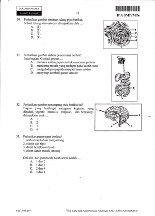 DOKUMENNEGARA
30. Perhatikan gambar struktur tulang pipa berikut.
Sel-sel tulang atau osteosit ditunjukkan oleh ....
A. (1)
B. (2)
c. (3)
D. (4)
31. Perhatikan gambar sistem pencernaan berikut!
Pada bagian X terjadi proses ....
A. memacu enzim pepsin untuk mencerna protein
B. mencerna protein yang terdapatpada kasein susu
C. mengubah polipeptida meqf adi asam amino
D. menyerap kernbali garam dan air
Perhatikan gambar penampang otak berikut ini!
Bagian yang berfungsi mengatur kegiatan yang
disadari, seperti: menulis, berjalan, dan bernyanyi
ditunjukkan oleh ....
A. 1
8.2
c.3
D.4
Perhatikan pernyataan berikut !
1. arah aliran keluar dari jantung
2. elastis dan tipis
3. darah bertekanan kuat
4. aliran darah masuk jantung
Ciri-ciri dari pembuluh darah arteri adalah .,..
A. I dan2
B. L dan3
C. 2 dan4
D. 3dan4
t2
rililtil rfl ililIilil iltilil ilfiilililil ilil
IPA SMP/MTh
32.
-)-,.
P-ZF-2011/2014 eHak Clipta pacla Pusat Peniltrian Pencliclikan-BALITBANG-KIIMDIKBL.ID
 