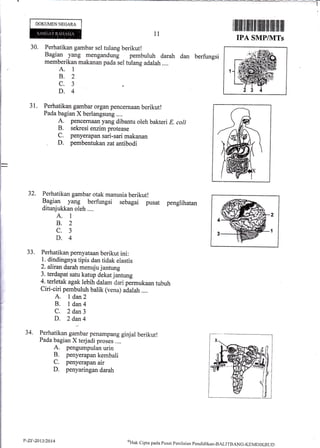 DOKUMENNEGARA
30. Perhatikan gambar sel tulang berikutl
Bagian yang mengandung pembuluh darah dan berfungsi
memberikan makanan pada sel tulang adalah ..,.
A. 1
B.2
c.3
D.4
31. Perhatikan gambar organ pencernaan berikut!
Pada bagian X berlangsung ....
A. pencernaan yang dibantu oleh bakteri E. coli
B. sekresi enzimprotease
C. penyerapan sari-sari makanan
, D. pembentukanzat antibodi
32. Perhatikan gambar otak manusia berikut!
Bagian yang berfungsi sebagai pusat penglihatan
ditunjukkan oleh ....
A. 1
8.2
c.3
D.4
33. Perhatikan pernyataan berikut ini:
1. dindingnya tipis dan tidak elastis
2. aliran darah menuju jantung
3. terdapat satu katup dekatjantung
4. terletak agak lebih dalam dari permukaan tubuh
Ciri-ciri pembuluh balik (vena) adalah....
A. I dan2
B. I dan4
C. 2 dan3
D. 2 dan4
/
34. Perhatikan gambar penampang ginjal berikut!
Pada bagian X terjadi proses ....
A. pengumpulan urin
B. penyerapan kembali
C. penyerapan air
D. penyaringan darah
1l
I ililllil ilt ilfl tlilt,tililflilt ililtilil fifl
IPA SMP/UITs
2
1
P-Zr-20t3t20t4 oHak
cipta pacla Pusirt pe.ilaian pendidiktrn-BALITBANG-KIMDIKBLiD
 
