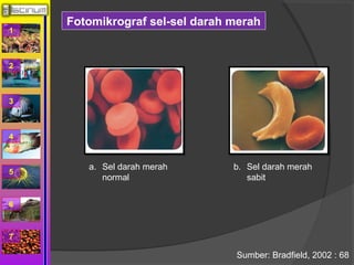 1 
2 
3 
4 
5 
6 
7 
Fotomikrograf sel-sel darah merah 
a. Sel darah merah 
normal 
b. Sel darah merah 
sabit 
Sumber: Bradfield, 2002 : 68 
 