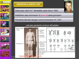 1 
2 
3 
4 
5 
6 
7 
SINDROM KLINEFELTER 
Ditemukan oleh H.F. Klinefelter pada tahun 1942. 
Kelebihan satu kromosom X (trisomi) pada gonosom. 
Penderita laki-laki dengan rumus kromosom 47, XXY. 
Laki-laki penderita sindrom Klinefelter 
Sindrom Klinefelter (47,XXY) 
 