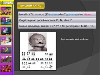 1 
2 
3 
4 
5 
6 
7 
SINDROM PATAU 
Memiliki 47 kromosom (45 autosom dan 2 gonosom) atau trisomi. 
Gagal berpisah pada kromosom 13, 14, atau 15. 
Rumus kromosom: laki-laki = 47,XY + 13; perempuan : 47,XX + 13. 
Bayi penderita sindrom Patau 
 