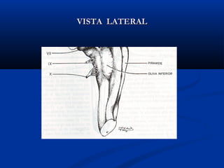 VISTA LATERALVISTA LATERAL
 