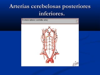 Arterias cerebelosas posterioresArterias cerebelosas posteriores
inferiores.inferiores.
 