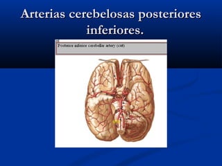 Arterias cerebelosas posterioresArterias cerebelosas posteriores
inferiores.inferiores.
 