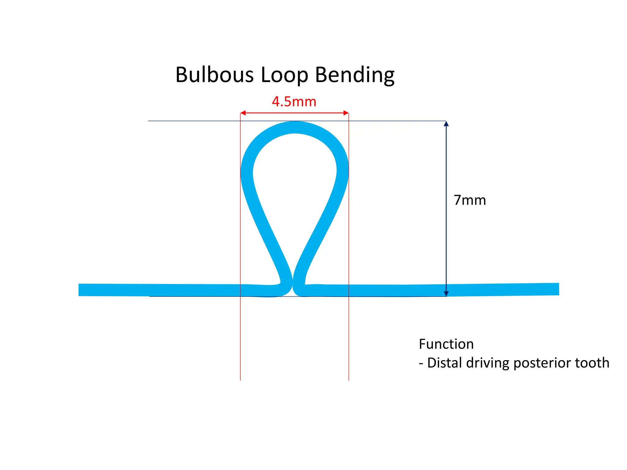 Bulbous Loop Bending
4.5mm
7mm
Function
- Distal driving posterior tooth
