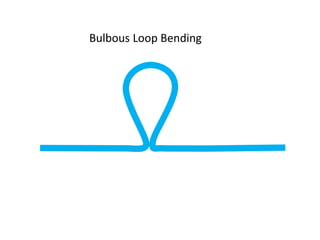 Bulbous Loop Bending
 