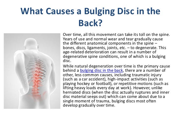 Managing Symptoms from a Bulging Disc in Your Back