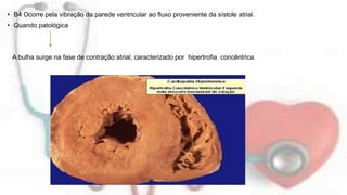 • B4 Ocorre pela vibração da parede ventricular ao fluxo proveniente da sístole atrial. 
• Quando patológica 
A bulha surge na fase de contração atrial, caracterizado por hipertrofia concêntrica. 
 