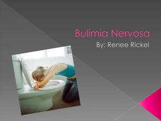 Bulimia Nervosa By: Renee Rickel 