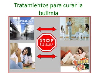 Tratamientos para curar la
        bulimia
 