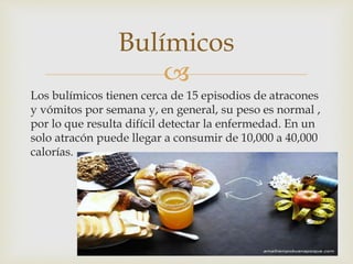 Bulímicos 
 
Los bulímicos tienen cerca de 15 episodios de atracones 
y vómitos por semana y, en general, su peso es normal , 
por lo que resulta difícil detectar la enfermedad. En un 
solo atracón puede llegar a consumir de 10,000 a 40,000 
calorías. 
 