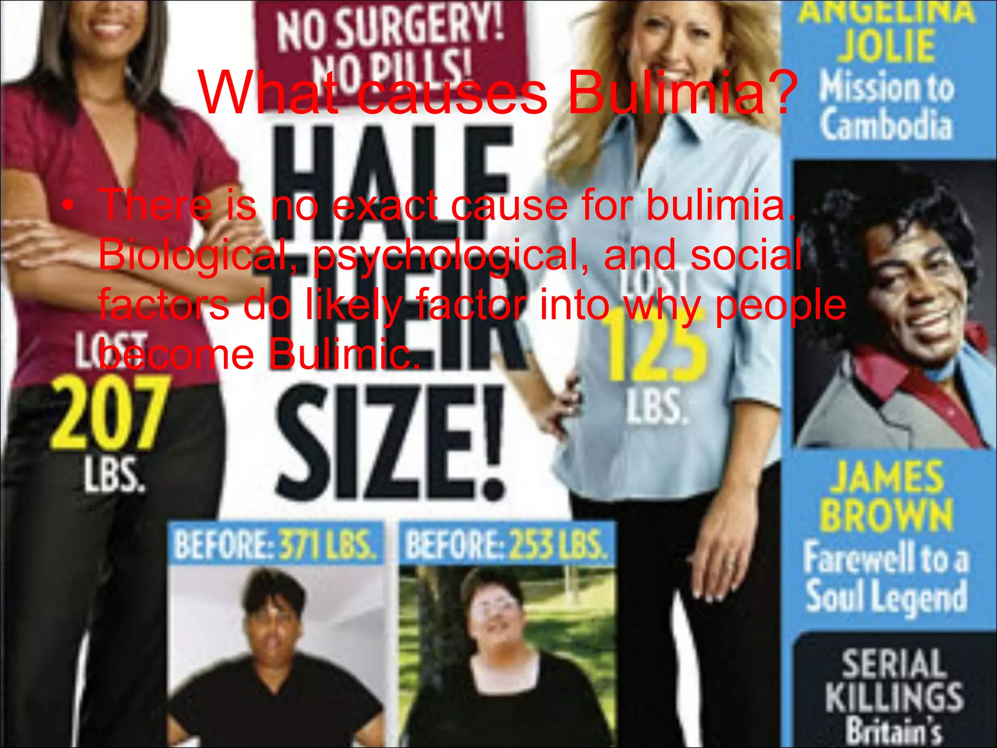 What causes Bulimia? There is no exact cause for bulimia. Biological, psychological, and social factors do likely factor into why people become Bulimic. 