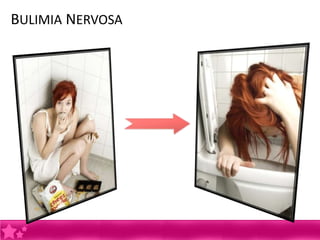 BULIMIA NERVOSA
 