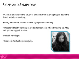 SIGNS AND SYMPTOMS

Calluses or scars on the knuckles or hands from sticking fingers down the
throat to induce vomiting.

Puffy “chipmunk” cheeks caused by repeated vomiting.

Discolored teeth from exposure to stomach acid when throwing up. May
look yellow, ragged, or clear.

Not underweight.

Frequent fluctuations in weight.
 