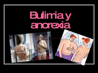 Bulimia y anorexia 
