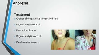 Anorexia
Treatment
o Change of the patient’s alimentary habits .
o Regular weight control.
o Restriction of sport.
o Regular analytic controls.
o Psychological therapy.

 