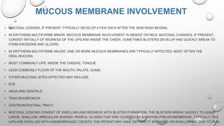 Bullous dermatoses and erythema multiformis | PPTX